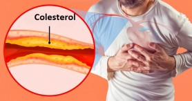 15 semne că ai artere înfundate cu colesterol